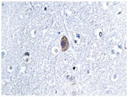 CNN2, Rabbit, Polyclonal Antibody, Abnova 100&mu;L; Unlabeled:Antibodies,