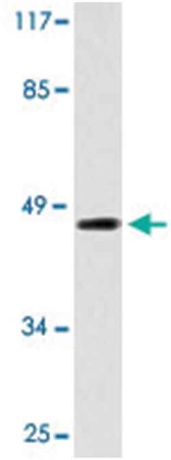 EDNRA Rabbit anti-Human, Mouse, Polyclonal Antibody, Abnova 100&mu;L; Unlabeled:Antibodies,