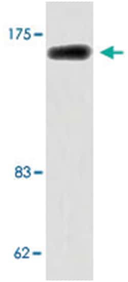 ALK Rabbit anti-Human, Mouse, Polyclonal Antibody, Abnova 100&mu;L; Unlabeled:Antibodies,