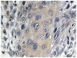 COPZ1, Rabbit, Polyclonal Antibody, Abnova 100&mu;L; Unlabeled:Antibodies,