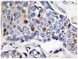 POLR3A Rabbit anti-Human, Mouse, Polyclonal Antibody, Abnova 100 &mu;L | Buy Online | Abnova | Fisher Scientific