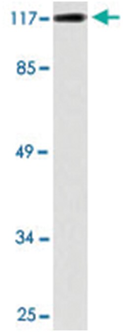 TUBGCP5, Rabbit, Polyclonal Antibody, Abnova 100 &mu;L | Buy Online | Abnova Corporation | Fisher Scientific