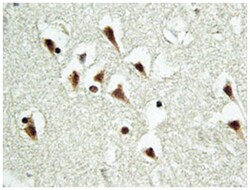 TUBGCP5, Rabbit, Polyclonal Antibody, Abnova 100 &mu;L | Buy Online | Abnova Corporation | Fisher Scientific