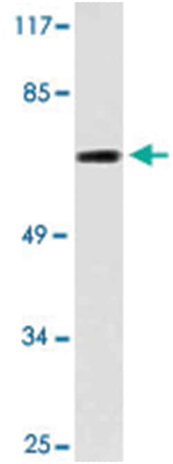 IQCB1, Rabbit, Polyclonal Antibody, Abnova 100 &mu;L | Buy Online | Abnova | Fisher Scientific