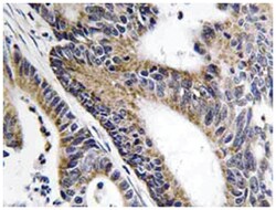 IQCB1, Rabbit, Polyclonal Antibody, Abnova 100 &mu;L | Buy Online | Abnova | Fisher Scientific