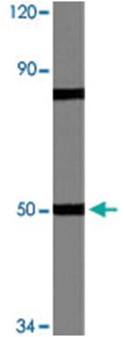 MRPS27, Rabbit, Polyclonal Antibody, Abnova 100 &mu;L | Buy Online | Abnova Corporation | Fisher Scientific