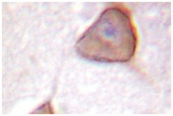 ADD1/ADD2, Rabbit, Polyclonal Antibody, Abnova 100&mu;L; Unlabeled:Antibodies,