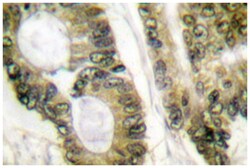 APC Rabbit anti-Human, Mouse, Rat, Polyclonal Antibody, Abnova 100 &mu;L | Buy Online | Abnova Corporation | Fisher Scientific