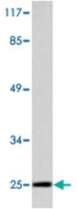 BAK1 Rabbit anti-Human, Mouse, Polyclonal Antibody, Abnova 100&mu;L; Unlabeled:Antibodies,