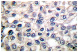 CTNNA1/CTNNA2, Rabbit, Polyclonal Antibody, Abnova 100&mu;L; Unlabeled:Antibodies,