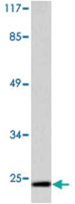 CLDN11 Rabbit anti-Human, Mouse, Rat, Polyclonal Antibody, Abnova 100 &mu;L | Buy Online | Abnova Corporation | Fisher Scientific