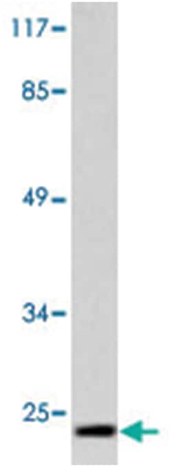 CLDN7 Rabbit anti-Human, Mouse, Rat, Polyclonal Antibody, Abnova 100 &mu;L | Buy Online | Abnova Corporation | Fisher Scientific