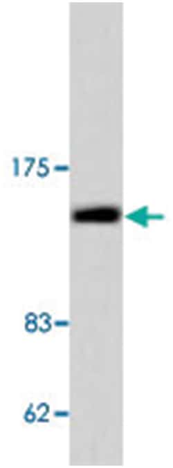 COL2A1 Rabbit anti-Human, Mouse, Rat, Polyclonal Antibody, Abnova 100 &mu;L | Buy Online | Abnova Corporation | Fisher Scientific