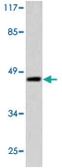 GJA1 Rabbit anti-Human, Mouse, Rat, Polyclonal Antibody, Abnova 100&mu;L;