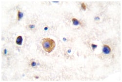 GJA1 Rabbit anti-Human, Mouse, Rat, Polyclonal Antibody, Abnova 100&mu;L;