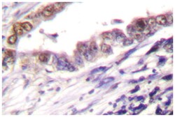 CCNA1/CCNA2, Rabbit, Polyclonal Antibody, Abnova 100&mu;L; Unlabeled:Antibodies,