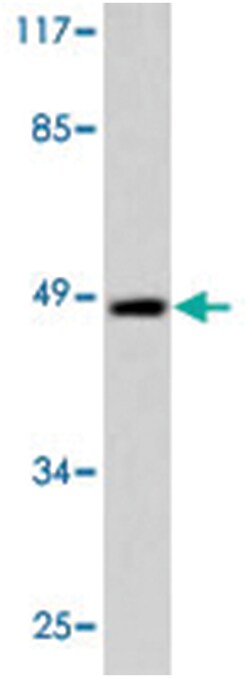 CCNE1 Rabbit anti-Human, Mouse, Rat, Polyclonal Antibody, Abnova 100&mu;L;