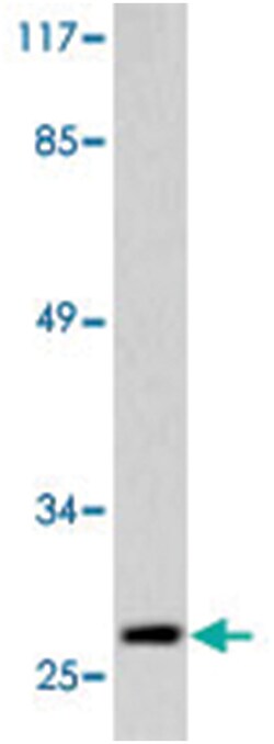 CCNG1, Rabbit, Polyclonal Antibody, Abnova 100 &mu;L | Buy Online | Abnova Corporation | Fisher Scientific