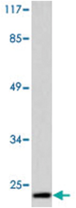 PARK7 Rabbit anti-Human, Mouse, Polyclonal Antibody, Abnova 100&mu;L; Unlabeled:Antibodies,