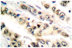 E2F4/E2F5, Rabbit, Polyclonal Antibody, Abnova 100 &mu;L | Buy Online | Abnova | Fisher Scientific