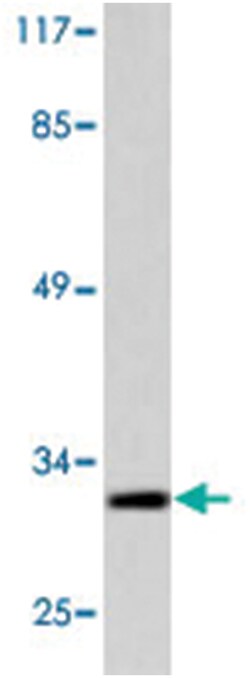 E2F6, Rabbit, Polyclonal Antibody, Abnova 100 &mu;L | Buy Online | Abnova Corporation | Fisher Scientific
