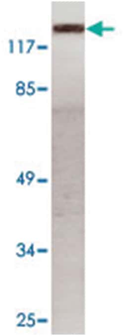 CDH1/CDH2/CDH3/CDH4, Rabbit, Polyclonal Antibody, Abnova 100 &mu;L | Buy Online | Abnova Corporation | Fisher Scientific