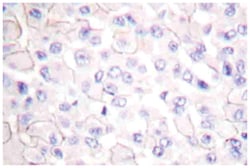 CDH1/CDH2/CDH3/CDH4, Rabbit, Polyclonal Antibody, Abnova 100 &mu;L | Buy Online | Abnova Corporation | Fisher Scientific