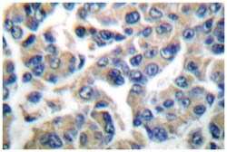 EEF2K Rabbit anti-Human, Rat, Polyclonal Antibody, Abnova 100 &mu;L | Buy Online | Abnova Corporation | Fisher Scientific