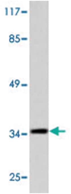 ERCC1 Rabbit anti-Human, Mouse, Polyclonal Antibody, Abnova 100 &mu;L | Buy Online | Abnova | Fisher Scientific