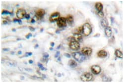 ERCC1 Rabbit anti-Human, Mouse, Polyclonal Antibody, Abnova 100 &mu;L | Buy Online | Abnova | Fisher Scientific