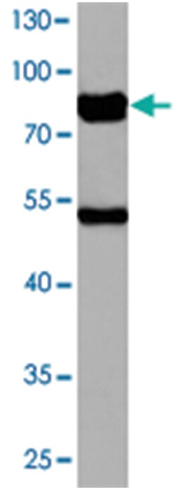 FGFR2 Rabbit anti-Human, Mouse, Polyclonal Antibody, Abnova 100 &mu;L | Buy Online | Abnova Corporation | Fisher Scientific