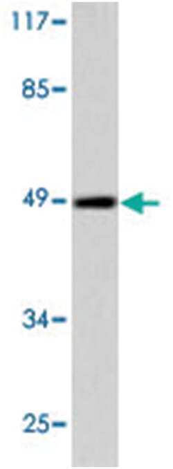 FLI1 Rabbit anti-Human, Mouse, Polyclonal Antibody, Abnova 100&mu;L; Unlabeled:Antibodies,