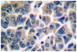 FLI1 Rabbit anti-Human, Mouse, Polyclonal Antibody, Abnova 100&mu;L; Unlabeled:Antibodies,