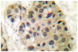 MCM3AP, Rabbit, Polyclonal Antibody, Abnova 100&mu;L; Unlabeled:Antibodies,