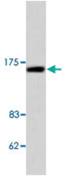 PTCH1 Rabbit anti-Human, Mouse, Polyclonal Antibody, Abnova 100&mu;L; Unlabeled:Antibodies,