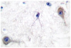 PTCH1 Rabbit anti-Human, Mouse, Polyclonal Antibody, Abnova 100&mu;L; Unlabeled:Antibodies,
