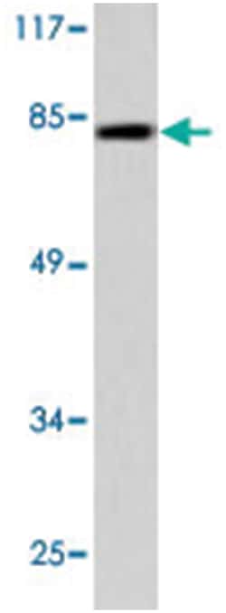 RAD17 Rabbit anti-Human, Mouse, Polyclonal Antibody, Abnova 100&mu;L; Unlabeled:Anticuerpos