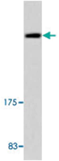 UBR5 Rabbit anti-Human, Mouse, Polyclonal Antibody, Abnova 100&mu;L; Unlabeled:Antibodies,