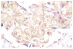 UBR5 Rabbit anti-Human, Mouse, Polyclonal Antibody, Abnova 100&mu;L; Unlabeled:Antibodies,