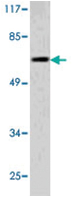 PIAS4 Rabbit anti-Human, Mouse, Polyclonal Antibody, Abnova 100 &mu;L | Buy Online | Abnova Corporation | Fisher Scientific