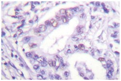 PIAS4 Rabbit anti-Human, Mouse, Polyclonal Antibody, Abnova 100 &mu;L | Buy Online | Abnova Corporation | Fisher Scientific