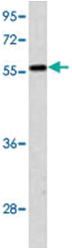 MKNK2 Rabbit anti-Human, Polyclonal Antibody, Abnova 400 &mu;L | Buy Online | Abnova | Fisher Scientific