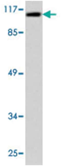SENP7 Rabbit anti-Human, Mouse, Polyclonal Antibody, Abnova 100 &mu;L | Buy Online | Abnova Corporation | Fisher Scientific