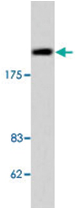 TOP2B Rabbit anti-Human, Mouse, Polyclonal Antibody, Abnova 100&mu;L; Unlabeled:Antibodies,