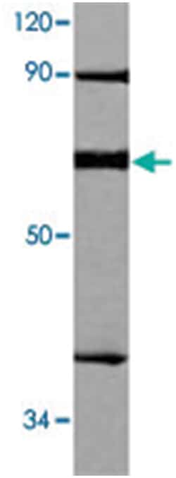 XRCC6 Rabbit anti-Human, Mouse, Polyclonal Antibody, Abnova 100 &mu;L | Buy Online | Abnova Corporation | Fisher Scientific