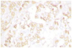 XRCC6 Rabbit anti-Human, Mouse, Polyclonal Antibody, Abnova 100 &mu;L | Buy Online | Abnova Corporation | Fisher Scientific