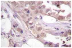 CDK7 Rabbit anti-Human, Mouse, Polyclonal Antibody, Abnova 100&mu;L; Unlabeled:Antibodies,