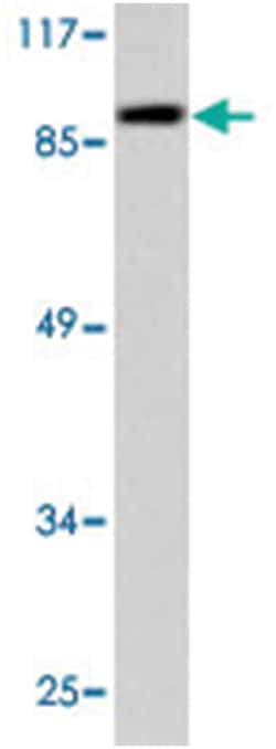 TFRC, Rabbit, Polyclonal Antibody, Abnova 100 &mu;L | Buy Online | Abnova Corporation | Fisher Scientific