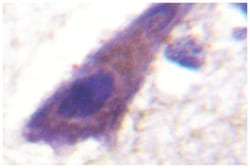 TFRC, Rabbit, Polyclonal Antibody, Abnova 100 &mu;L | Buy Online | Abnova Corporation | Fisher Scientific