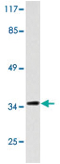 FOSB Rabbit anti-Human, Mouse, Polyclonal Antibody, Abnova 100 &mu;L | Buy Online | Abnova Corporation | Fisher Scientific